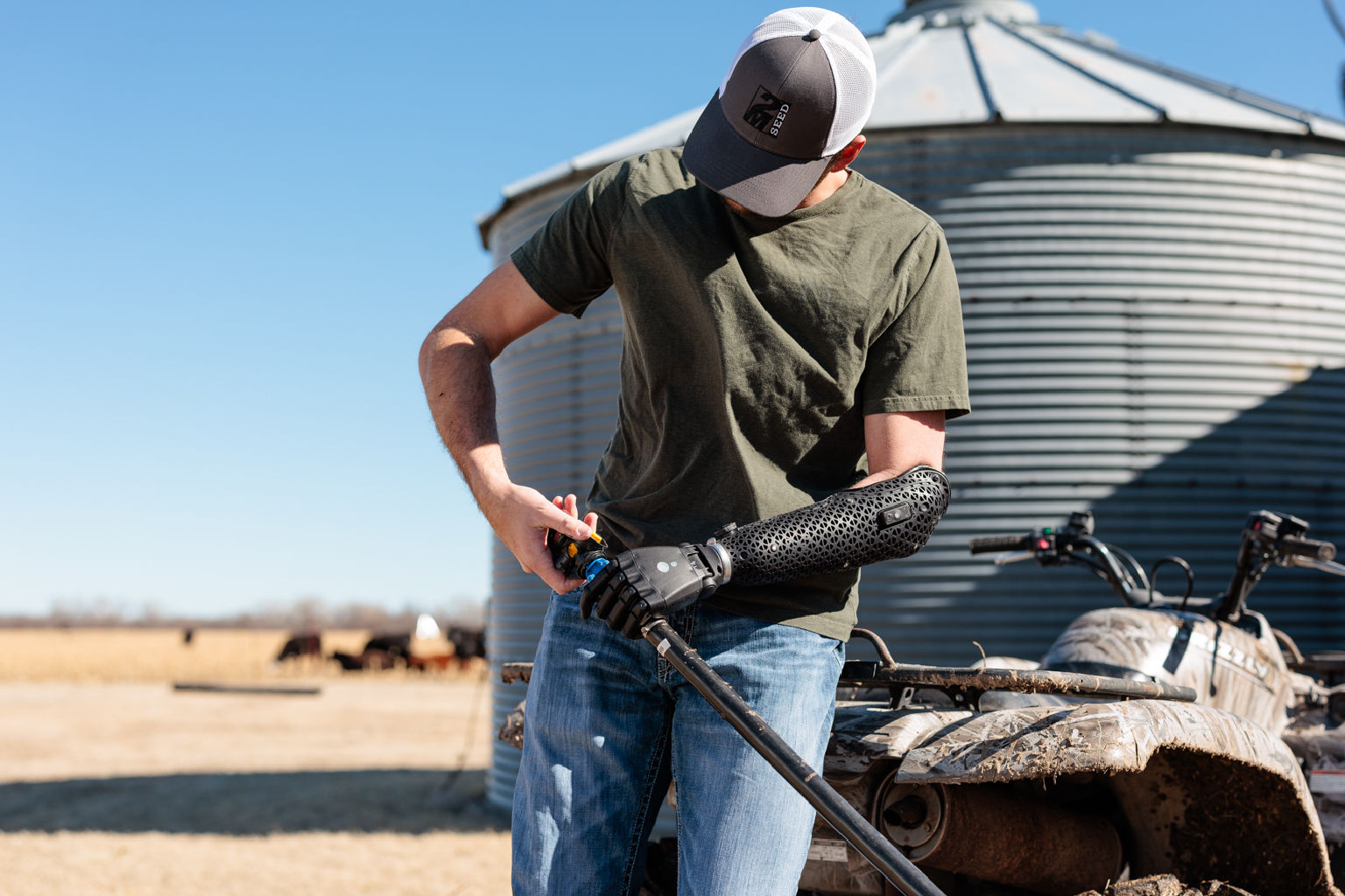 Hero Arm user performing everyday tasks