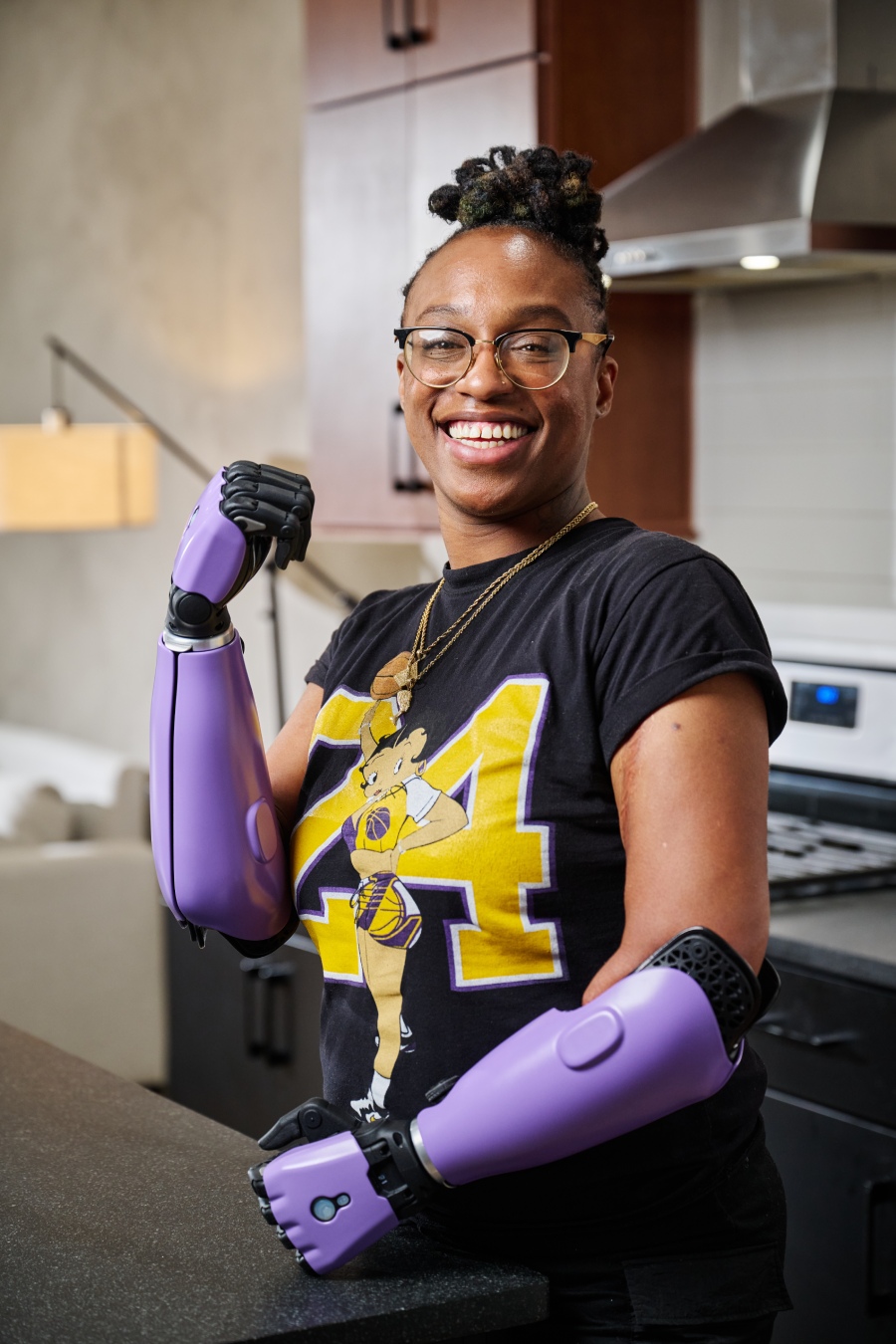 lady with bionic arm
