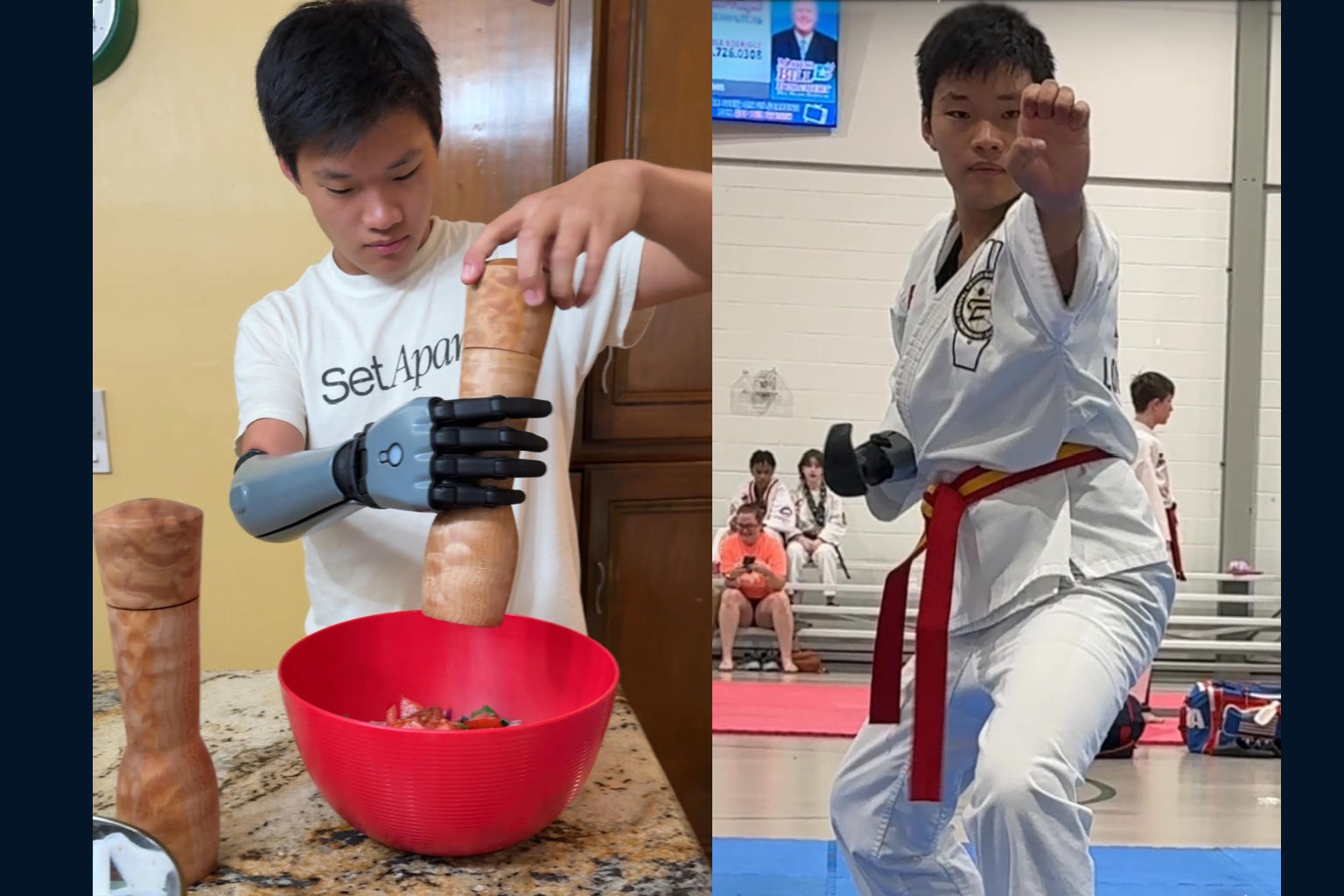 Prosthetist fitting and training a patient on a Hero Arm