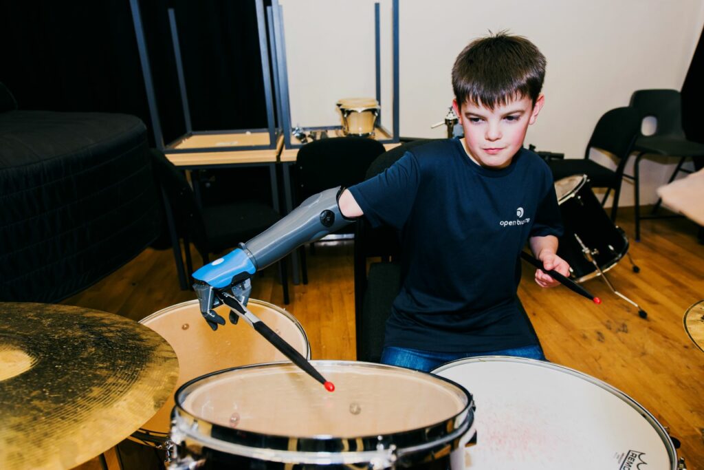Child with Hero Arm engaged in sport or activity