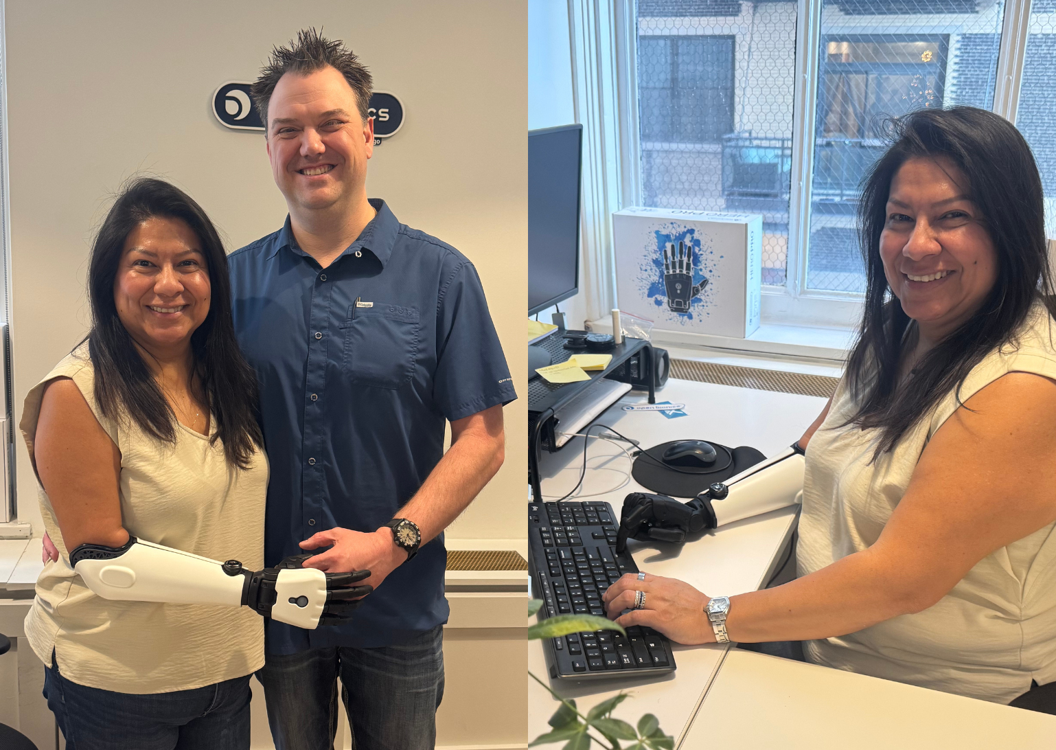 Person using a myoelectric prosthetic arm in daily life