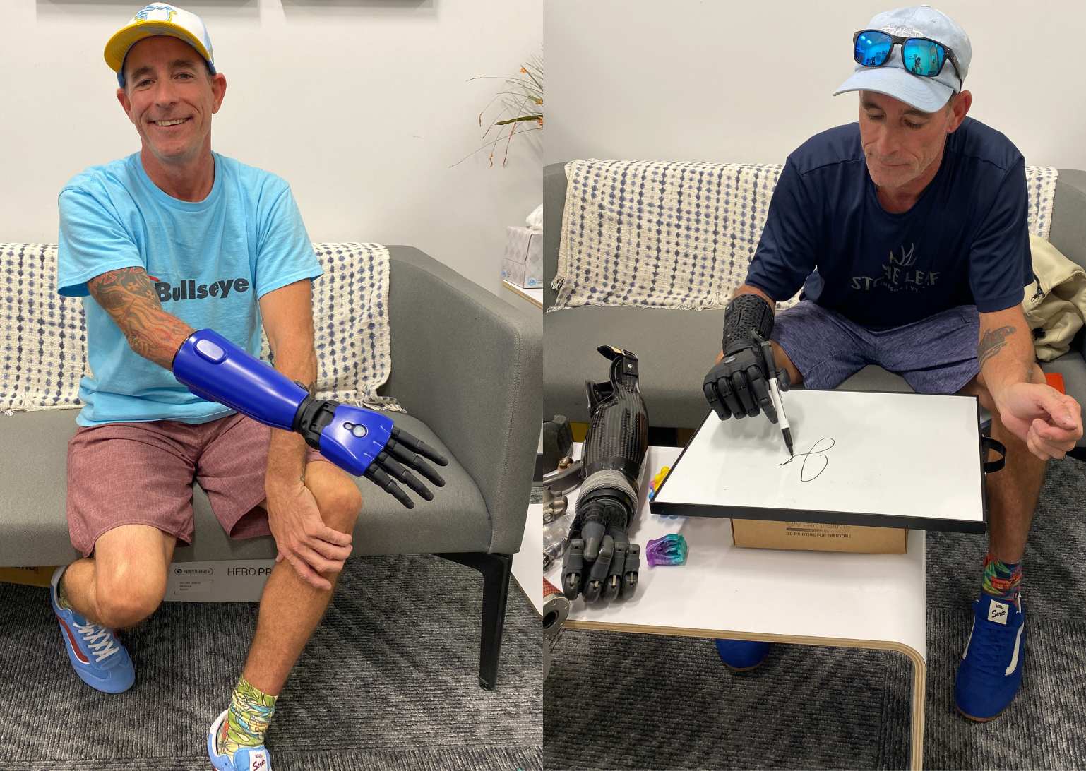 Person with below-elbow limb difference using a Hero Arm or Hero PRO